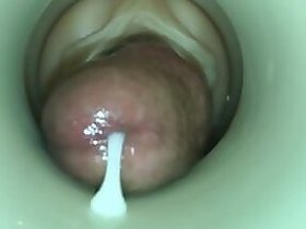 Unobstructed settling is not related to Cum Cam Man